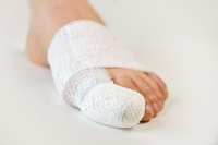 The Basics of Broken Toes