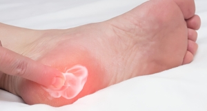 The Hidden Reason Your Heel Still Hurts — And How We Treat Heel Spurs That Just Won’t Go Away.