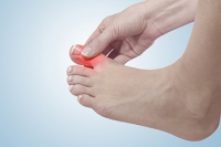 Arthritis of the Big Toe