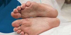 Diabetic Foot Care — What Happens When You Don’t Prioritize Professional Foot Care
